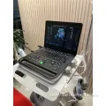 Portable 4D Ultrasound Machine for Veterinary Use